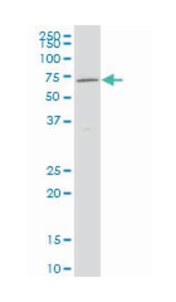 NR4A2, Mouse, Clone: 1C6, Abnova 100&mu;g; Unlabeled:Anticuerpos
