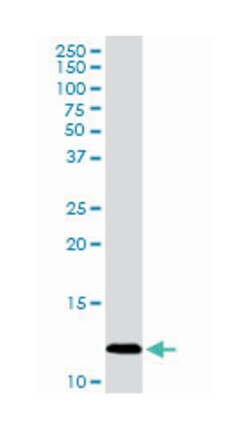 platelet factor 4, Rabbit, Purified MaxPab Polyclonal Antibody, Abnova 100 &mu;g | Buy Online | Abnova | Fisher Scientific