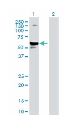 serpin peptidase inhibitor, clade A (alpha-1 antiproteinase, antitrypsin),