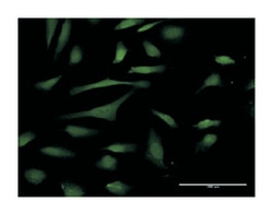 protein (peptidylprolyl cis/trans isomerase) NIMA-interacting, 4 (parvulin),