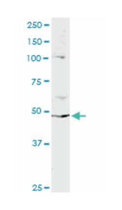 PPP2R2B, Mouse, Clone: 1F3, Abnova 100 &mu;g | Buy Online | Abnova Corporation | Fisher Scientific
