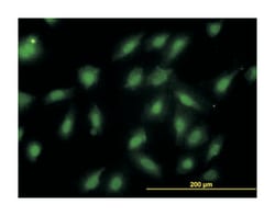 proteasome (prosome, macropain) subunit, beta type, 6, Mouse, Clone: S51,