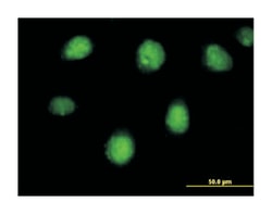 retinoic acid receptor, beta, Mouse, Polyclonal Antibody, Abnova 50 &mu;g | Buy Online | Abnova | Fisher Scientific