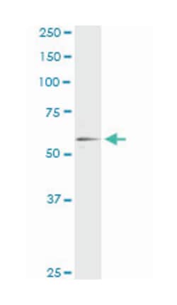 retinoid X receptor, alpha, Mouse, Clone: 4B5, Abnova 100&mu;g; Unlabeled:Antibodies,