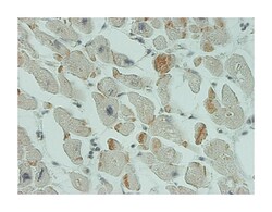 anti-SMN2, Clone: 2B11-2A9, Abnova 100 &mu;g | Buy Online | Abnova Corporation | Fisher Scientific