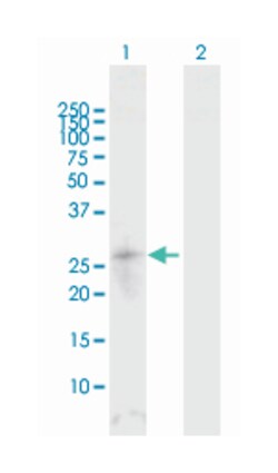 SPR, Rabbit, MaxPab Polyclonal Antibody, Abnova 100 &mu;L | Buy Online | Abnova Corporation | Fisher Scientific