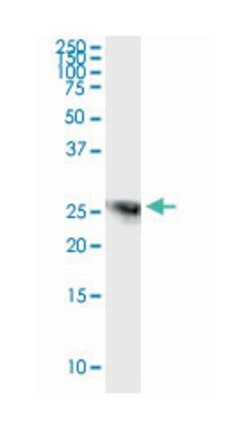 SPR, Rabbit, MaxPab Polyclonal Antibody, Abnova 100 &mu;L | Buy Online | Abnova Corporation | Fisher Scientific