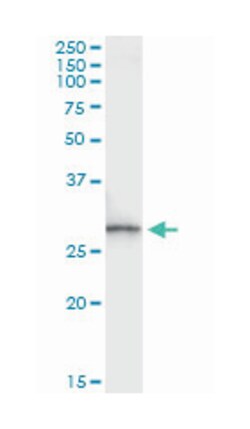 SPR, Mouse, Clone: 4F2, Abnova 100 &mu;g | Buy Online | Abnova Corporation | Fisher Scientific