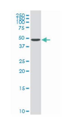 tripartite motif-containing 21, Mouse, Polyclonal Antibody, Abnova 50&mu;L;