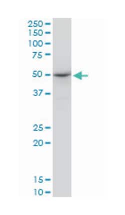 Sjogren syndrome antigen B (autoantigen La), Mouse, Polyclonal Antibody, Abnova 50 &mu;L | Buy Online | Abnova Corporation | Fisher Scientific