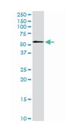 STK3, Mouse, Clone: 4F7, Abnova 200&mu;L; Unlabeled:Antibodies, Monoclonal