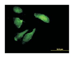 serine/threonine kinase 11, Mouse, Purified MaxPab Polyclonal Antibody,