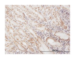 small nuclear RNA activating complex, polypeptide 4, 190kDa, Mouse, Clone: 1D1, Abnova 100 &mu;g | Buy Online | Abnova Corporation | Fisher Scientific