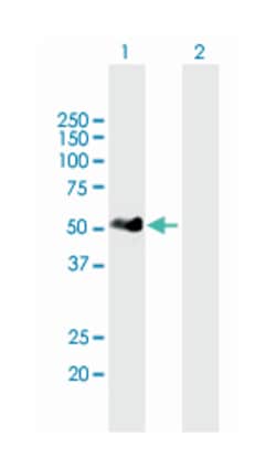 interferon regulatory factor 3, Mouse, Polyclonal Antibody, Abnova 50&mu;L;