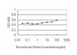 lipase A, lysosomal acid, cholesterol esterase, Mouse, Clone: 1F9, Abnova 100 &mu;g | Buy Online | Abnova Corporation | Fisher Scientific