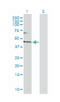 fatty acid desaturase 3, Rabbit, Purified MaxPab Polyclonal Antibody, Abnova