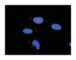 matrix metallopeptidase 2 (gelatinase A, 72kDa gelatinase, 72kDa type IV