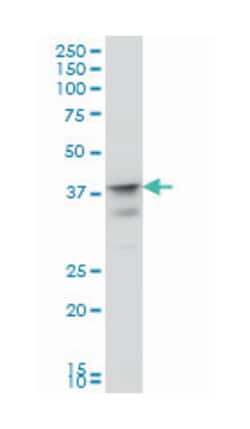 musashi homolog 1 (Drosophila), Mouse, Clone: 3F2, Abnova 100 &mu;g | Buy Online | Abnova Corporation | Fisher Scientific