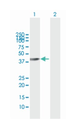 ARK2, Rabbit, MaxPab Polyclonal Antibody, Abnova 100 &mu;L | Buy Online | Abnova | Fisher Scientific