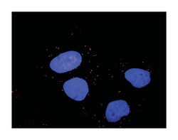 v-raf-1 murine leukemia viral oncogene homolog 1, Mouse, Clone: 1H4, Abnova 100 &mu;g | Buy Online | Abnova | Fisher Scientific