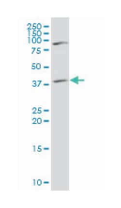 ST3 beta-galactoside alpha-2,3-sialyltransferase 4, Mouse, Polyclonal Antibody,