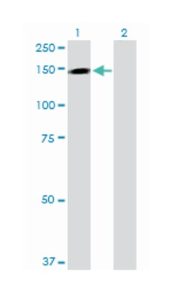 trafficking protein particle complex 10, Rabbit, Purified MaxPab Polyclonal Antibody, Abnova 100 &mu;g | Buy Online | Abnova | Fisher Scientific