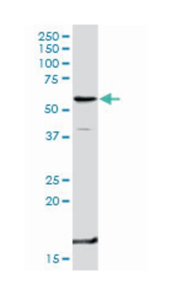 tumor necrosis factor receptor superfamily, member 1B, Rabbit, Purified