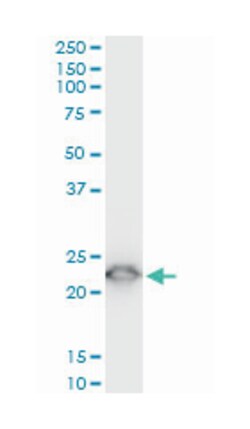 tumor protein, translationally-controlled 1, Mouse, Clone: 2C4, Abnova