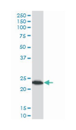 tumor protein, translationally-controlled 1, Mouse, Clone: 2C4, Abnova