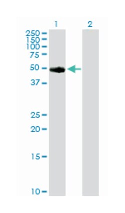 tyrosinase (oculocutaneous albinism IA), Rabbit, Purified MaxPab Polyclonal