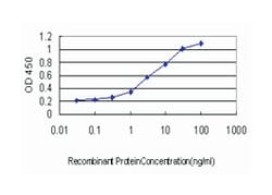 ubiquitin-conjugating enzyme E2G 2 (UBC7 homolog, yeast), Mouse, Clone: