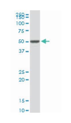 vaccinia related kinase 1, Rabbit, Purified MaxPab Polyclonal Antibody, Abnova 100 &mu;g | Buy Online | Abnova Corporation | Fisher Scientific