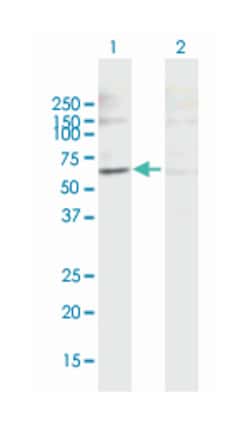 X-linked Kx blood group (McLeod syndrome), Mouse, Polyclonal Antibody, Abnova&trade;