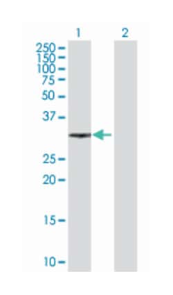 X-ray repair complementing defective repair in Chinese hamster cells 2, Mouse, Purified MaxPab™ Polyclonal Antibody, Abnova™