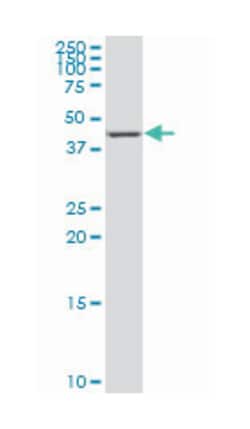 nuclear receptor subfamily 4, group A, member 3, Mouse, Clone: 1E9, Abnova