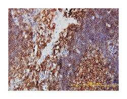 protein kinase, interferon-inducible double stranded RNA dependent activator,