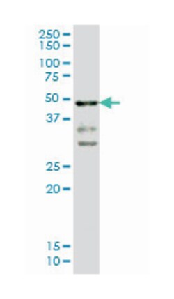 T, brachyury homolog (mouse), Mouse, Clone: 5C5, Abnova 100&mu;g; Unlabeled:Antibodies,