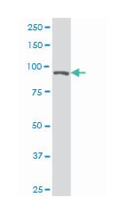 transcription elongation factor B (SIII), polypeptide 3 (110kDa, elongin