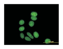 zinc finger protein 354A (B01), Mouse anti-Human, Polyclonal Antibody, Abnova 50 &mu;L | Buy Online | Abnova Corporation | Fisher Scientific