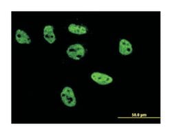 transcription factor AP-2 beta (activating enhancer binding protein 2 beta),