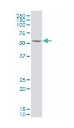 KLF10, Mouse, Clone: 2H2, Abnova 100&mu;g; Unlabeled:Antibodies, Monoclonal