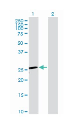 thymidine kinase 1, soluble, Rabbit, Purified MaxPab Polyclonal Antibody, Abnova 100 &mu;g | Buy Online | Abnova Corporation | Fisher Scientific