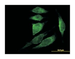 thymosin beta 4, X-linked, Mouse, Purified MaxPab&trade; Polyclonal Antibody, Abnova&trade;