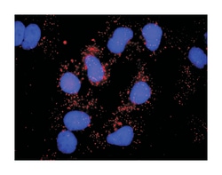 hemopoietic cell kinase, Rabbit, Purified MaxPab Polyclonal Antibody, Abnova