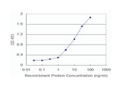 HK2, Mouse, Clone: 4H1, Abnova 100&mu;g; Unlabeled:Antibodies, Monoclonal