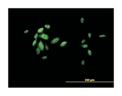forkhead box A2, Mouse, Clone: 7E6, Abnova 100&mu;g; Unlabeled:Antibodies,
