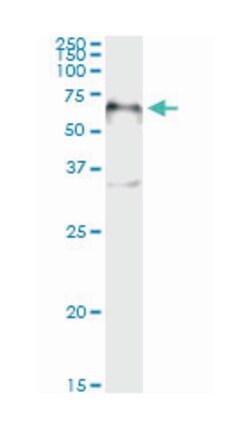 forkhead box A2, Mouse, Clone: 1C7, Abnova 100&mu;g; Unlabeled:Antibodies,