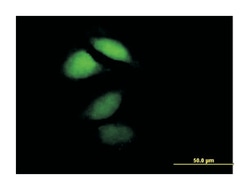 hippocalcin, Mouse, Purified MaxPab Polyclonal Antibody, Abnova 50 &mu;g | Buy Online | Abnova Corporation | Fisher Scientific