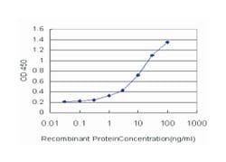 inhibitor of DNA binding 2, dominant negative helix-loop-helix protein,