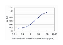 potassium inwardly-rectifying channel, subfamily J, member 10, Mouse, Clone: 1C11, Abnova 100 &mu;g | Buy Online | Abnova Corporation | Fisher Scientific